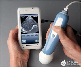 健康与智能的结合 医疗电子产品面面观